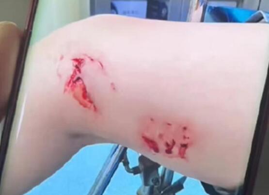 游客被不明鱼类咬伤 救援人员发声  内幕曝光简直太意外了