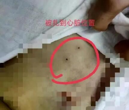 医院回应穿刺失误致女童死亡  背后真相实在令人感到惊愕