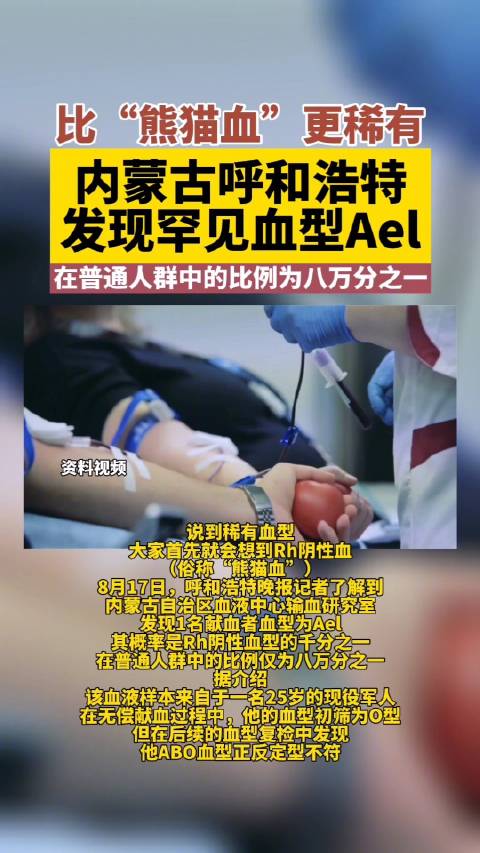 呼和浩特发现比熊猫血更稀有血型Ael 这到底是怎么回事？