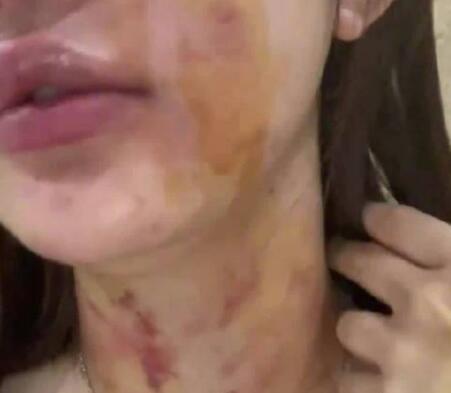 23岁女子自曝遭夫妻两人殴打扒衣 真相简直令人震惊 内幕曝光简直太意外了