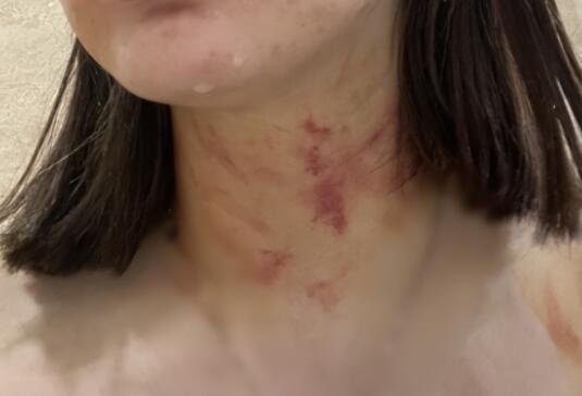 女子遭夫妻扒衣掐脖?警方介入 背后真相令人感到震惊