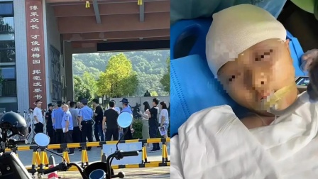长沙一家长称孩子被老师打破头骨 情况危急涉事教师已被带走